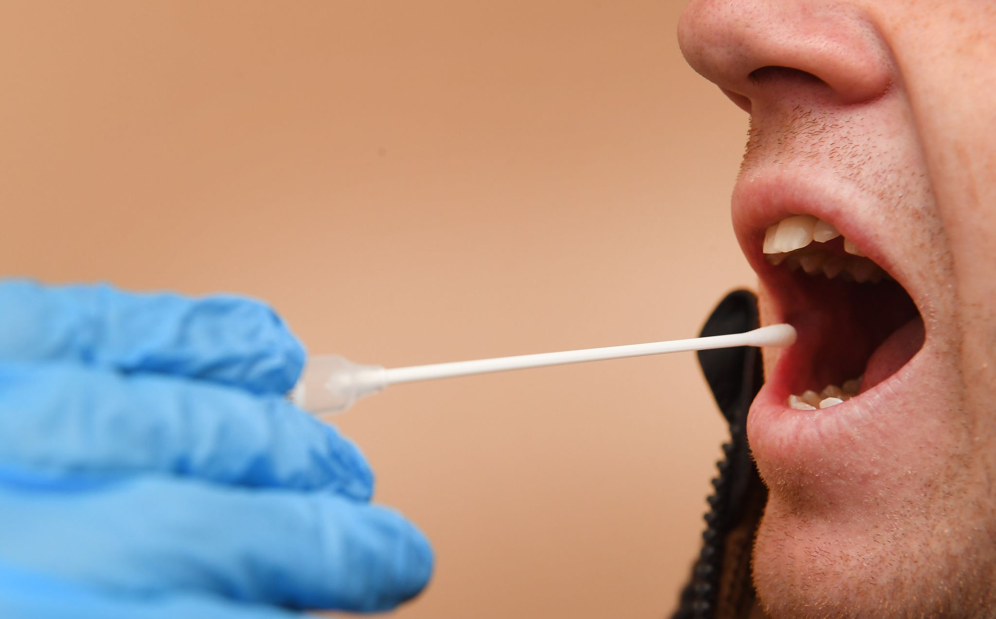 Mann schickt Freund zu Vaterschaftstest – Bewährungsstrafe