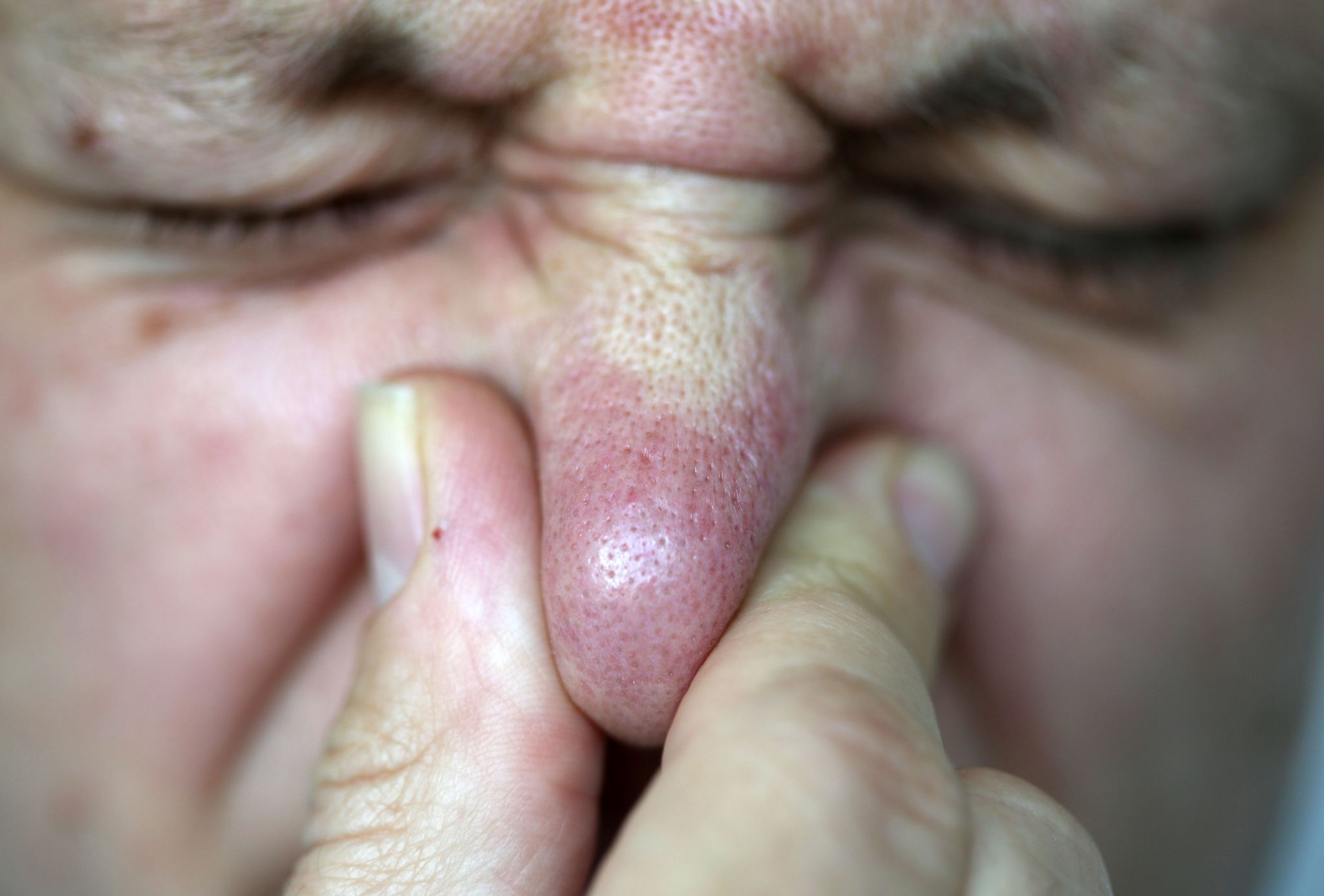 Ursache für Gestank am Untermain gefunden